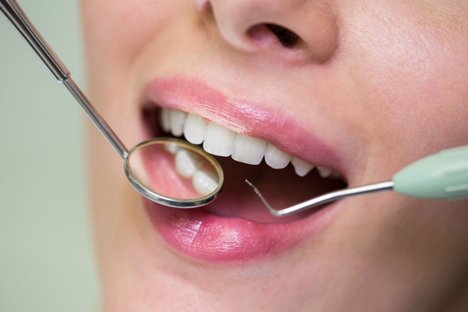 revision dental en espai dental valencia