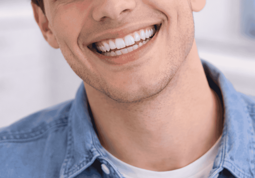 Sonrisa de paciente tras realizarse la ortodoncia invisible en Valencia con Espai Dental